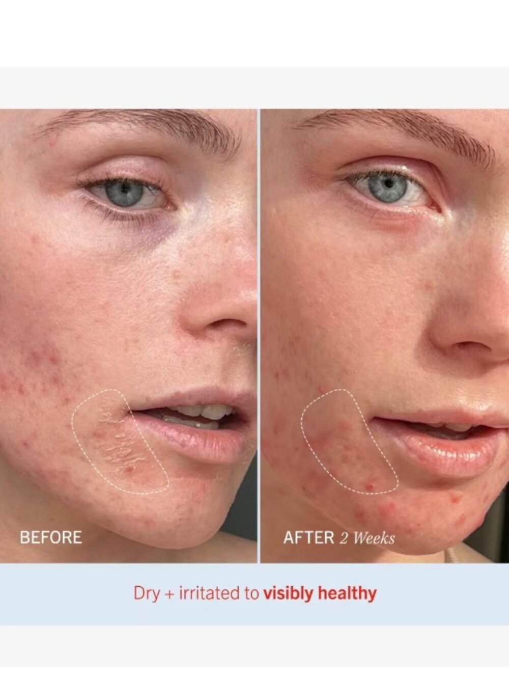 First Aid Beauty Skincare Set-Ultra Repair Cream Intense Hydration Skin-2pc-NEW - Picture 7 of 16